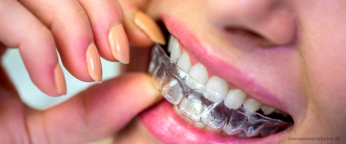 ¿Cuánto tiempo dura una férula dental?