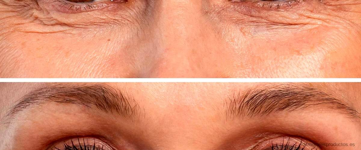 Descubre las opiniones sobre Skin Doctors Eyetuck y su efectividad contra las ojeras