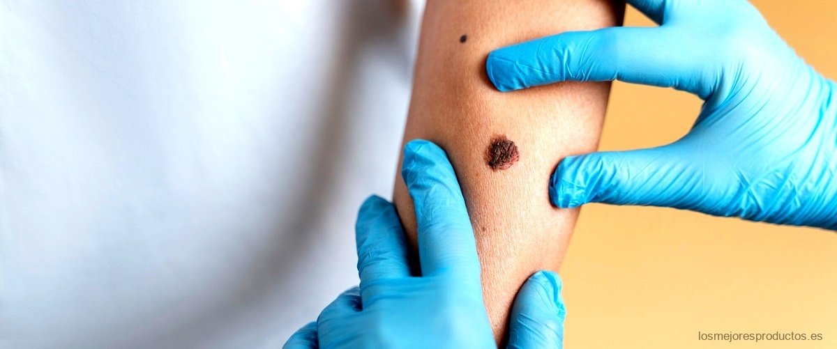 Eukanuba Dermatosis FP Barato: la opción asequible para tratar problemas de piel