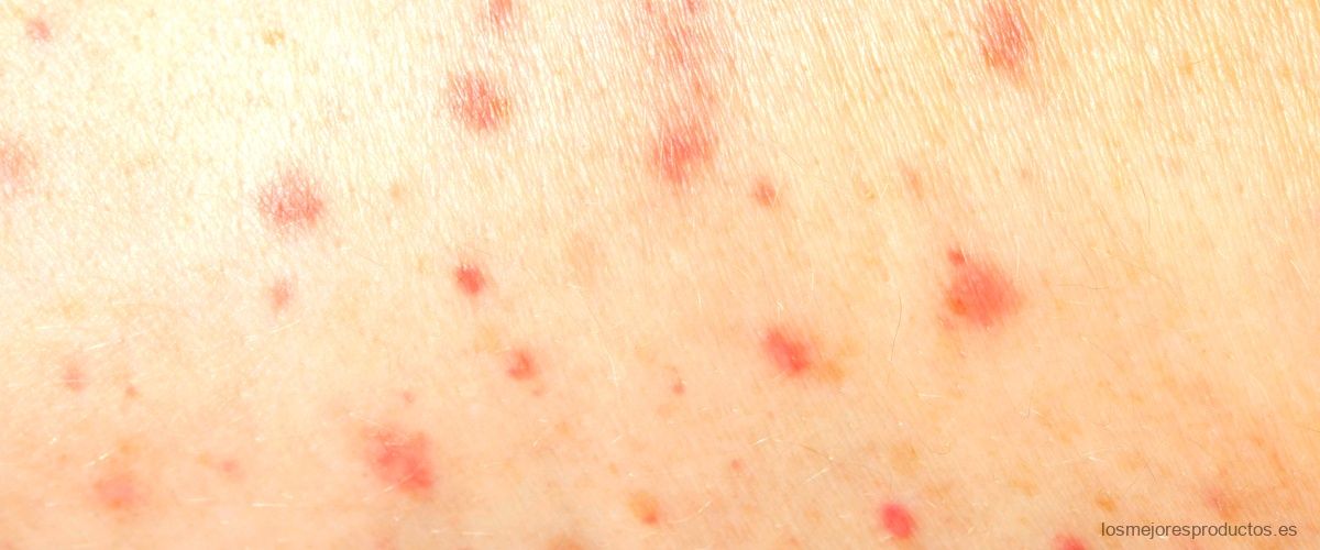Poster de dermatomas: identifica fácilmente las zonas de la piel involucradas