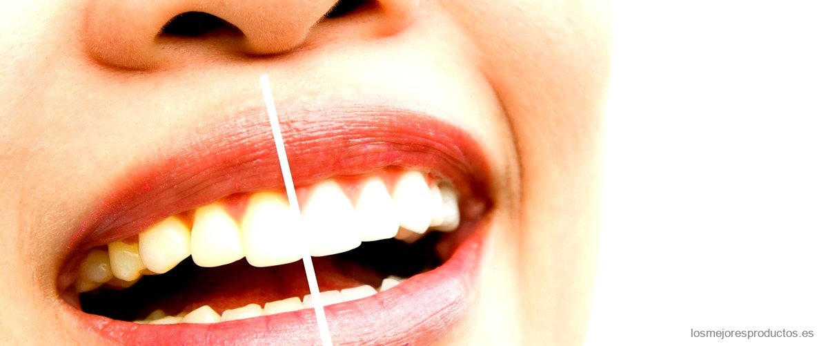 ¿Cuál es el mejor blanqueador dental casero?